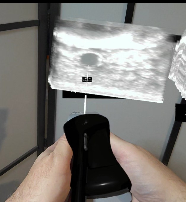 Person tracking injury recovery with Triad