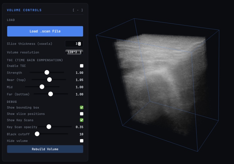 3D volumetric ultrasound scan viewed in the Triad viewer